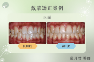 orthodontics case 1 1
