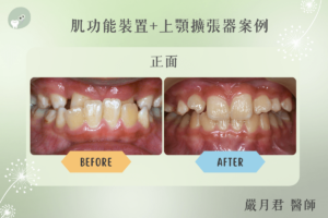 orthodontics case 3 1